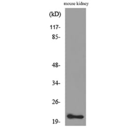 Western Blot - Anti-ADM Antibody (C30148) - Antibodies.com