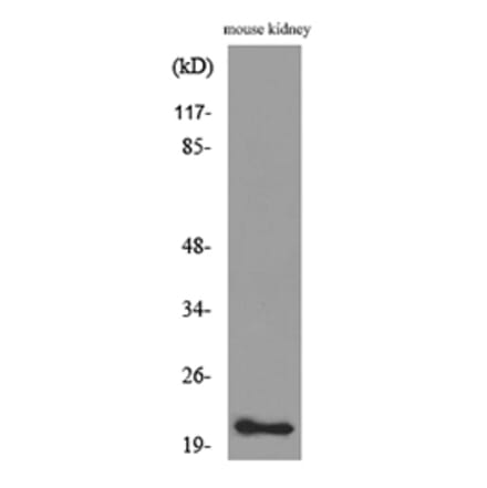 Western Blot - Anti-ADM Antibody (C30148) - Antibodies.com