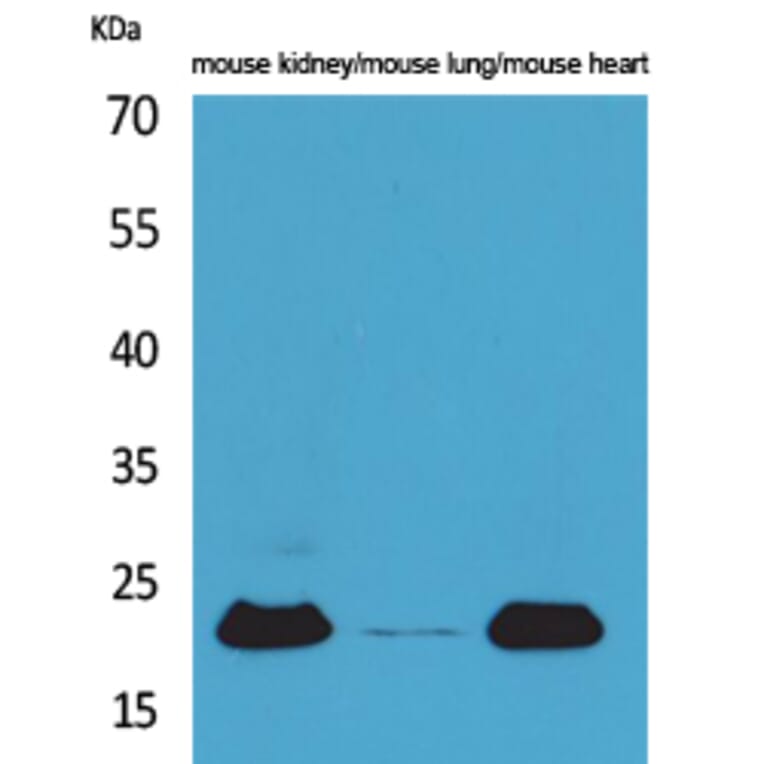 Western Blot - Anti-ADM Antibody (C30148) - Antibodies.com