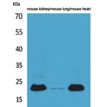 Western Blot - Anti-ADM Antibody (C30148) - Antibodies.com