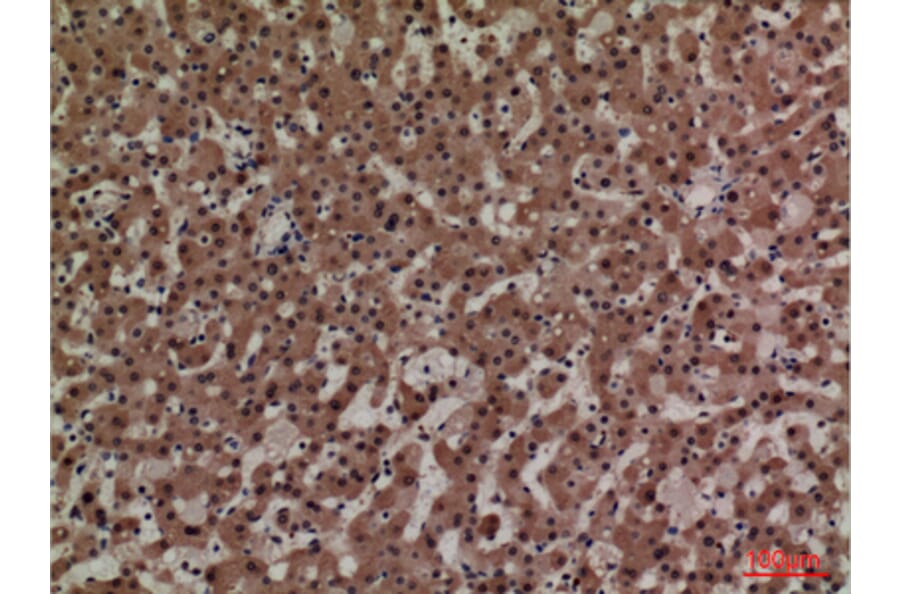 Immunohistochemistry - Anti-ADM Antibody (C30148) - Antibodies.com