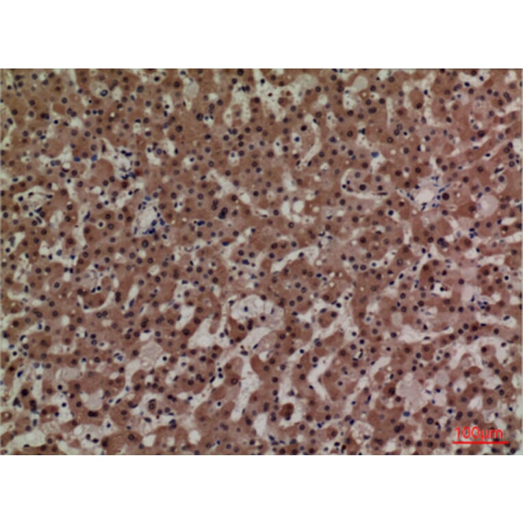 Immunohistochemistry - Anti-ADM Antibody (C30148) - Antibodies.com