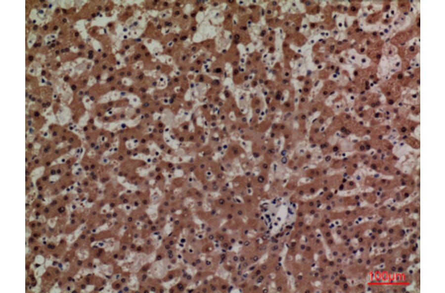 Immunohistochemistry - Anti-ADM Antibody (C30148) - Antibodies.com