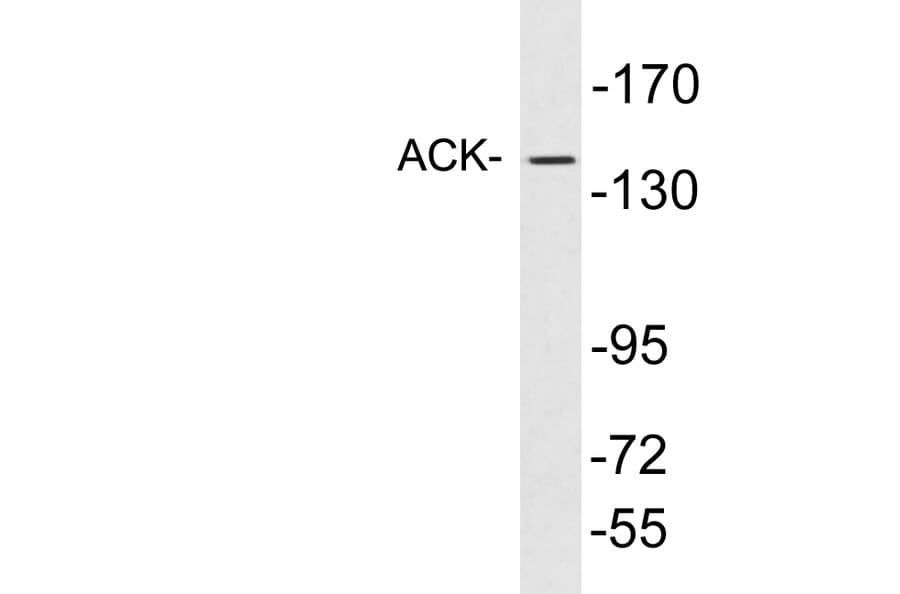 Western Blot - Anti-ACK Antibody (R12-2010) - Antibodies.com