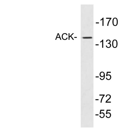 Western Blot - Anti-ACK Antibody (R12-2010) - Antibodies.com