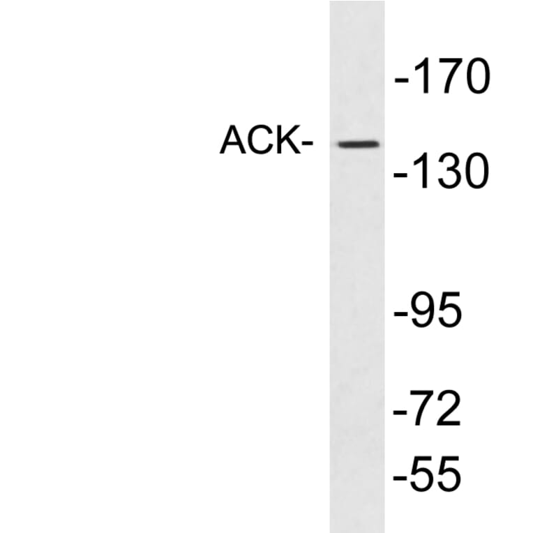 Western Blot - Anti-ACK Antibody (R12-2010) - Antibodies.com