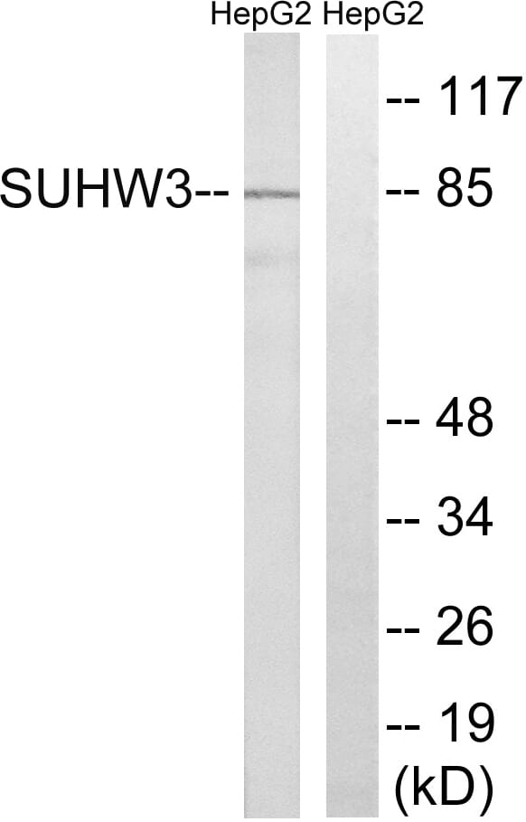 Western blot analysis of lysates from HepG2 cells using Anti-ZNF280C Antibody. The right hand lane represents a negative control, where the antibody is blocked by the immunising peptide.