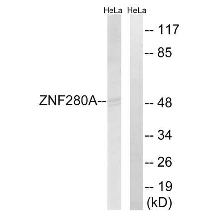 Western Blot - Anti-ZNF280A Antibody (C18985) - Antibodies.com