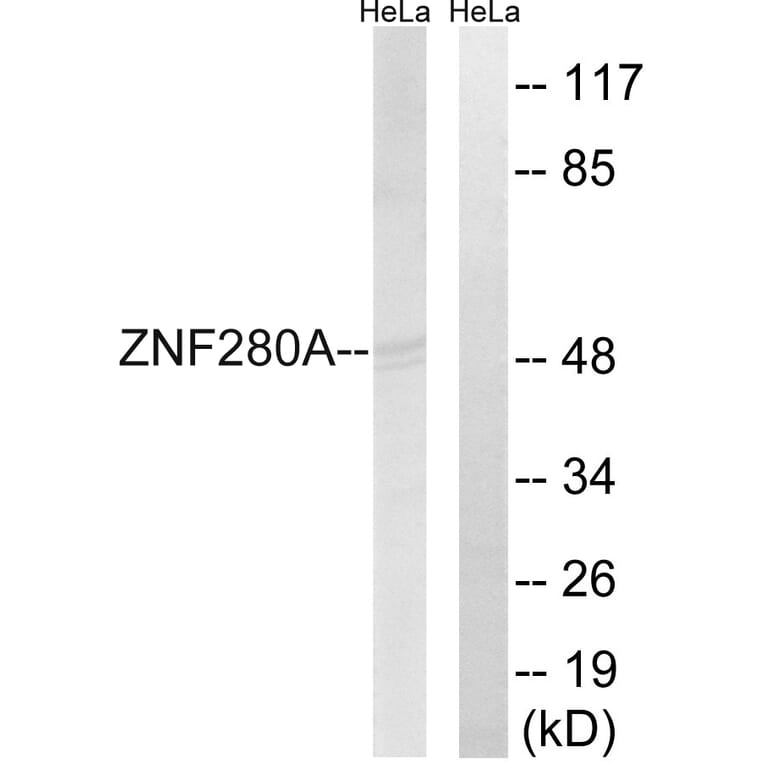 Western Blot - Anti-ZNF280A Antibody (C18985) - Antibodies.com