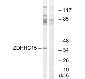 Western Blot - Anti-ZDHHC15 Antibody (C17595) - Antibodies.com