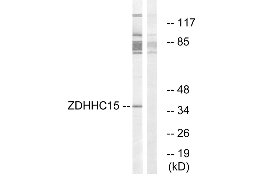 Western Blot - Anti-ZDHHC15 Antibody (C17595) - Antibodies.com