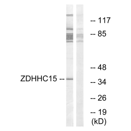 Western Blot - Anti-ZDHHC15 Antibody (C17595) - Antibodies.com