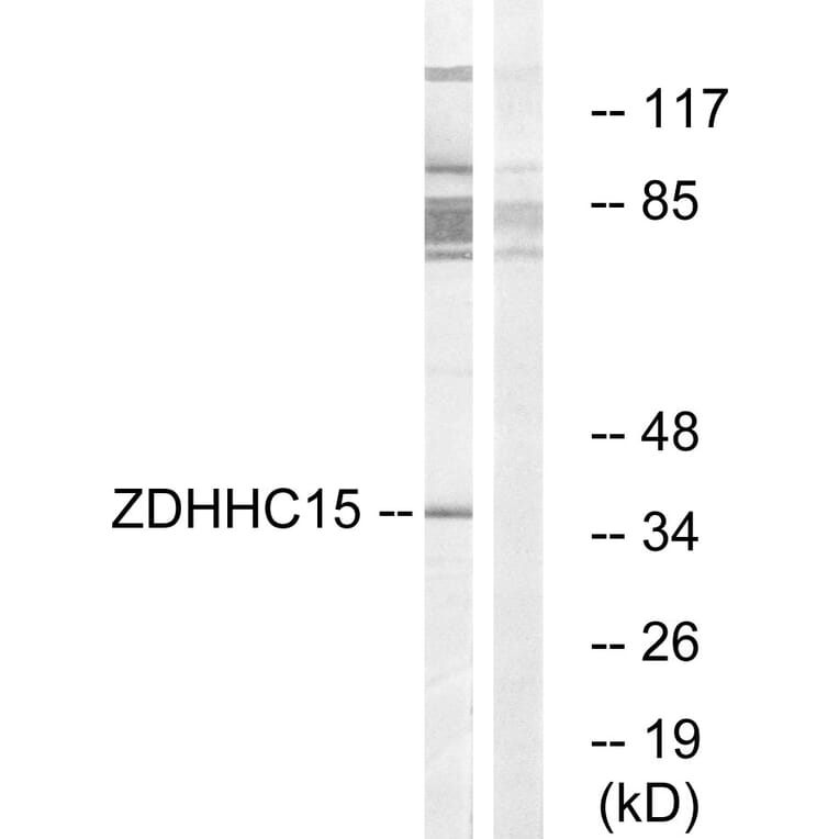 Western Blot - Anti-ZDHHC15 Antibody (C17595) - Antibodies.com