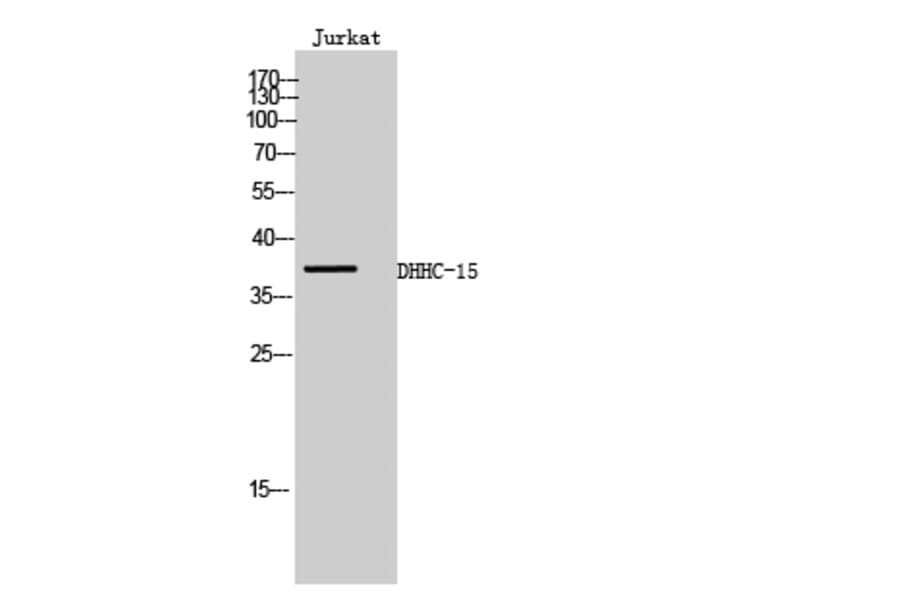 Western Blot - Anti-ZDHHC15 Antibody (C17595) - Antibodies.com