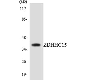 Western Blot - Anti-ZDHHC15 Antibody (R12-3690) - Antibodies.com