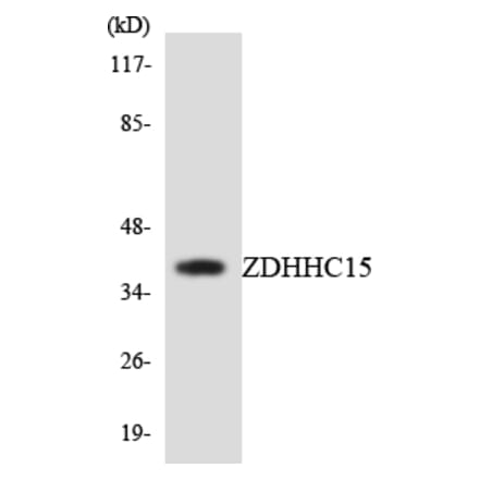 Western Blot - Anti-ZDHHC15 Antibody (R12-3690) - Antibodies.com
