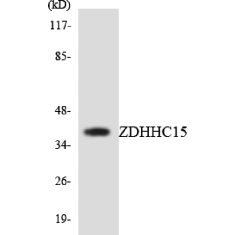 Western Blot - Anti-ZDHHC15 Antibody (R12-3690) - Antibodies.com