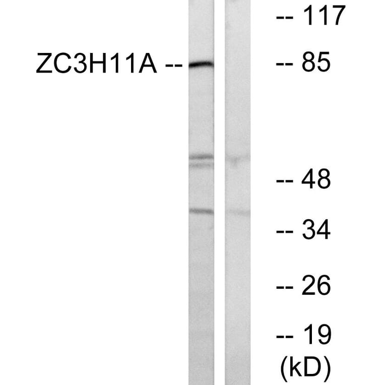 Western Blot - Anti-ZC3H11A Antibody (C19574) - Antibodies.com