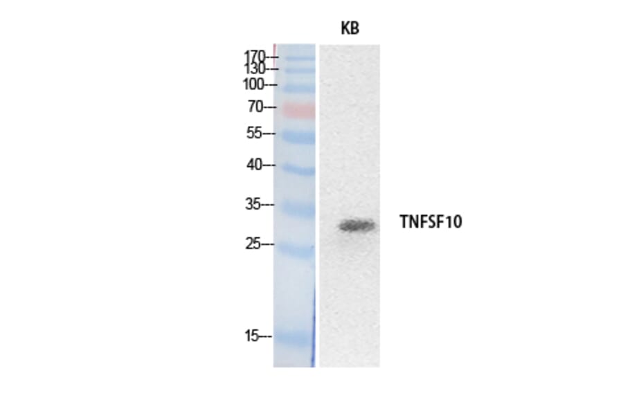 Western Blot - Anti-TNFSF10 Antibody (C30464) - Antibodies.com