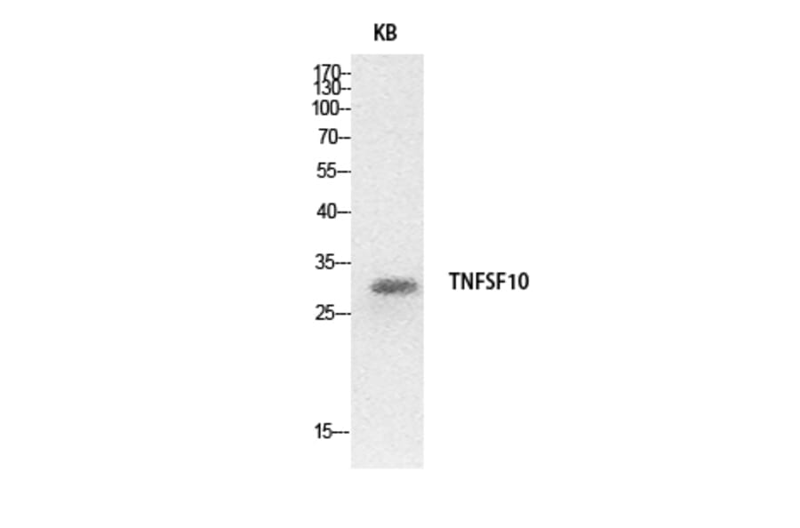 Western Blot - Anti-TNFSF10 Antibody (C30464) - Antibodies.com