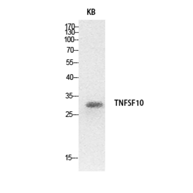 Western Blot - Anti-TNFSF10 Antibody (C30464) - Antibodies.com