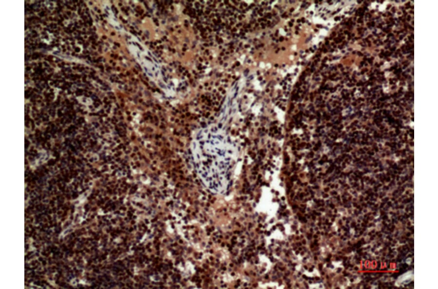 Immunohistochemistry - Anti-TNFSF10 Antibody (C30464) - Antibodies.com