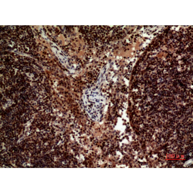 Immunohistochemistry - Anti-TNFSF10 Antibody (C30464) - Antibodies.com
