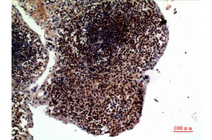 Immunohistochemistry - Anti-TNFSF10 Antibody (C30464) - Antibodies.com