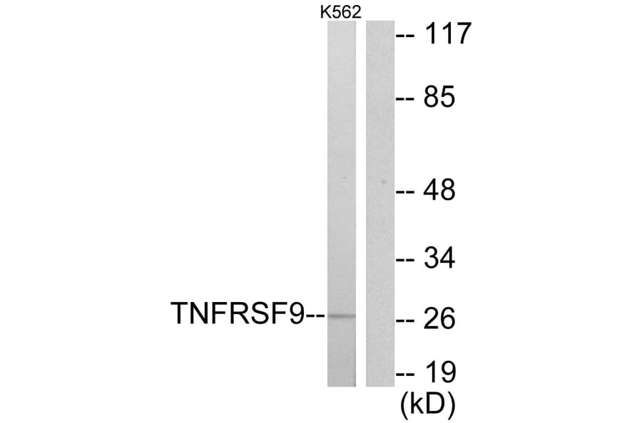 Western Blot - Anti-TNFRSF9 Antibody (C10899) - Antibodies.com