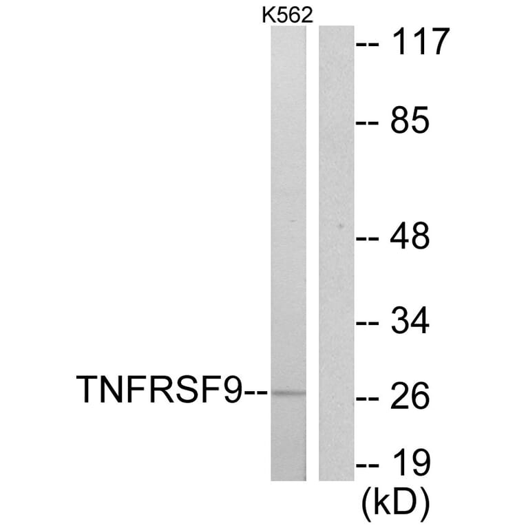Western Blot - Anti-TNFRSF9 Antibody (C10899) - Antibodies.com
