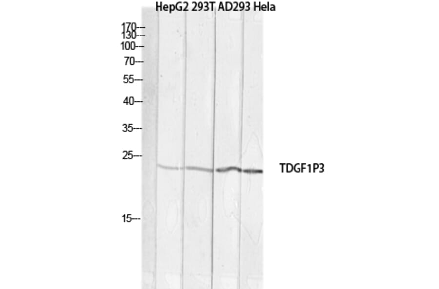 Western Blot - Anti-TDGF1P3 Antibody (C30623) - Antibodies.com