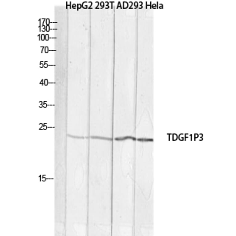 Western Blot - Anti-TDGF1P3 Antibody (C30623) - Antibodies.com