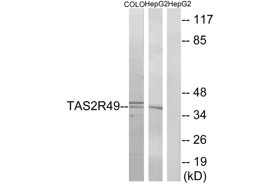 Western Blot - Anti-TAS2R49 Antibody (G759) - Antibodies.com
