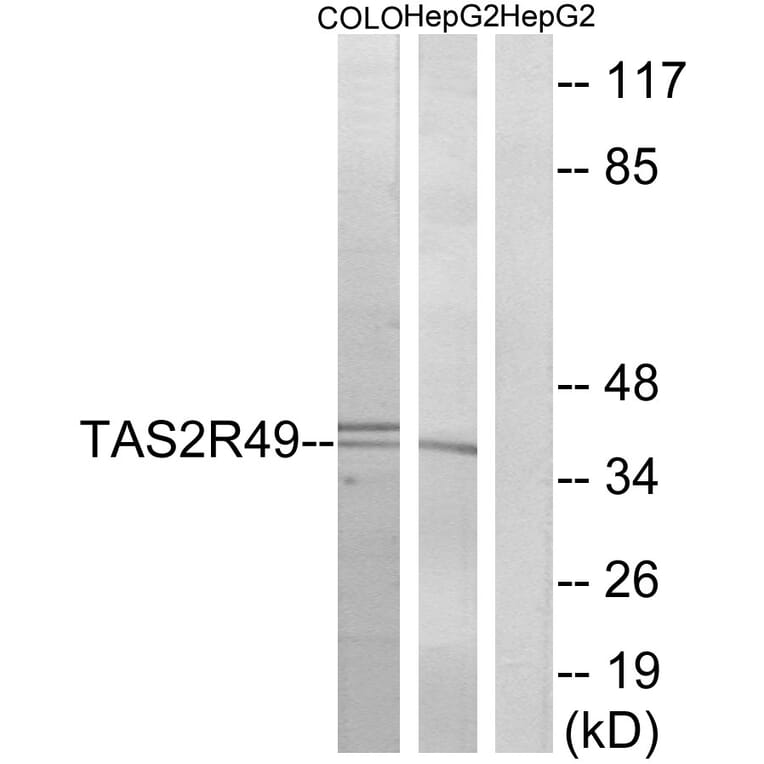 Western Blot - Anti-TAS2R49 Antibody (G759) - Antibodies.com