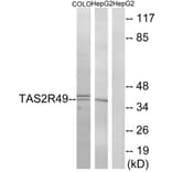 Western Blot - Anti-TAS2R49 Antibody (G759) - Antibodies.com