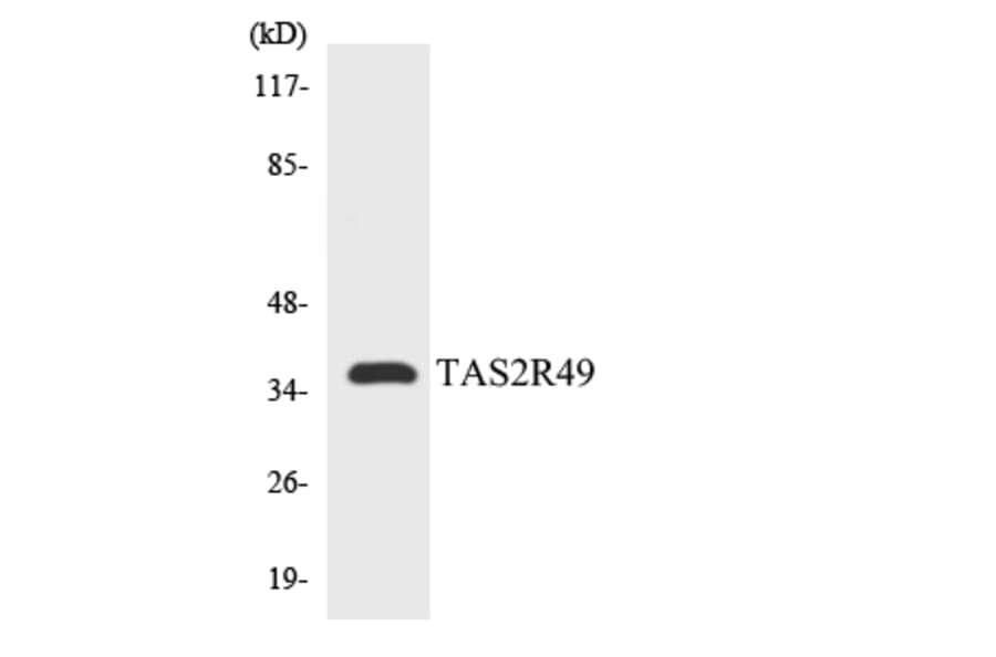 Western Blot - Anti-TAS2R49 Antibody (R12-3595) - Antibodies.com