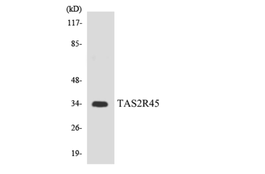 Western Blot - Anti-TAS2R45 Antibody (R12-3594) - Antibodies.com
