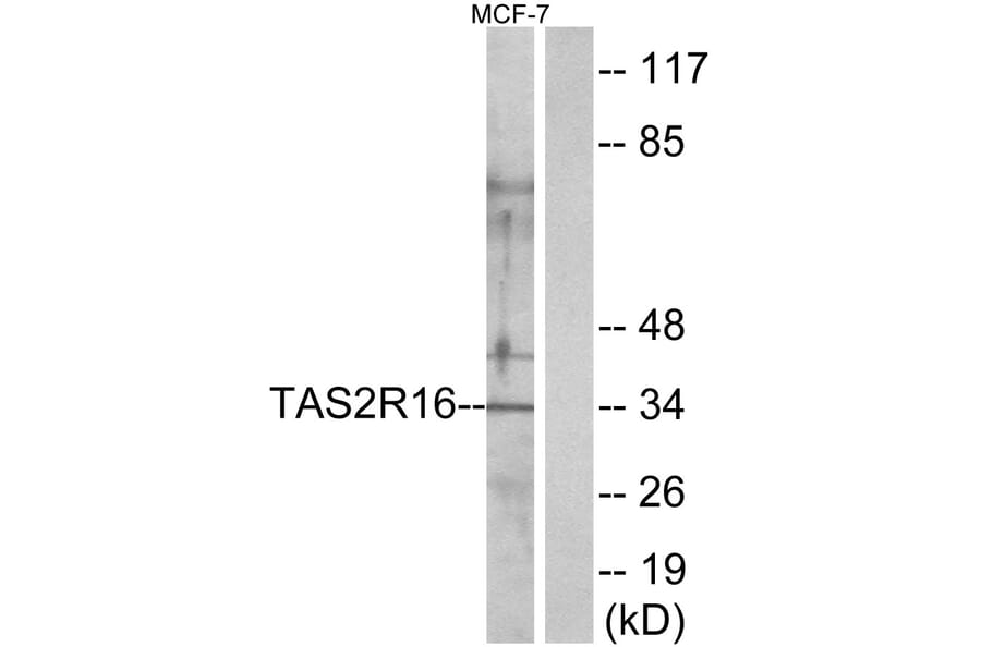 Western Blot - Anti-TAS2R16 Antibody (G754) - Antibodies.com