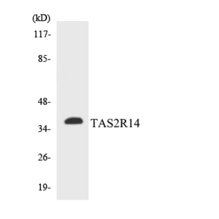 Western Blot - Anti-TAS2R14 Antibody (R12-3591) - Antibodies.com