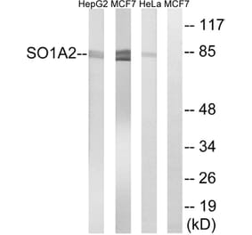 Western Blot - Anti-SLCO1A2 Antibody (C18884) - Antibodies.com