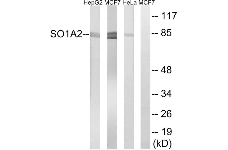 Western Blot - Anti-SLCO1A2 Antibody (C18884) - Antibodies.com