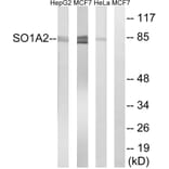 Western Blot - Anti-SLCO1A2 Antibody (C18884) - Antibodies.com