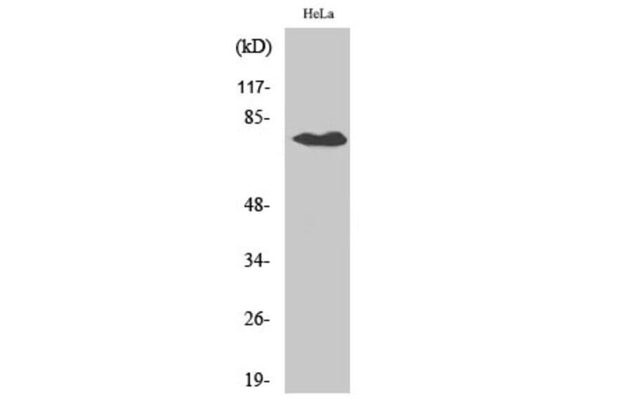 Western Blot - Anti-SLCO1A2 Antibody (C18884) - Antibodies.com