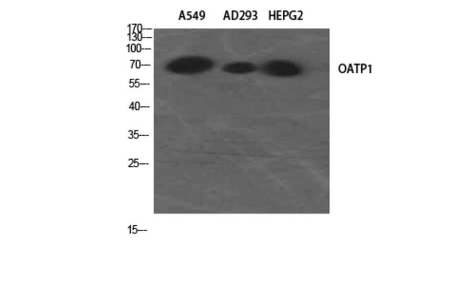 Western Blot - Anti-SLCO1A2 Antibody (C18884) - Antibodies.com