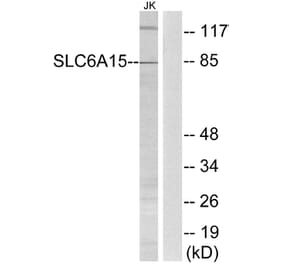 Western Blot - Anti-SLC6A15 Antibody (C17577) - Antibodies.com
