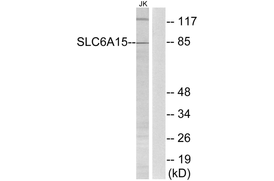 Western Blot - Anti-SLC6A15 Antibody (C17577) - Antibodies.com