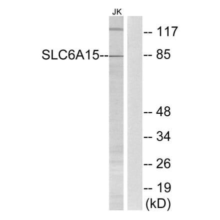 Western Blot - Anti-SLC6A15 Antibody (C17577) - Antibodies.com