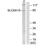 Western Blot - Anti-SLC6A15 Antibody (C17577) - Antibodies.com