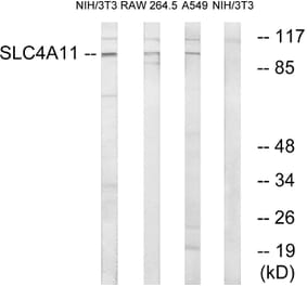 Western Blot - Anti-SLC4A11 Antibody (C18807) - Antibodies.com