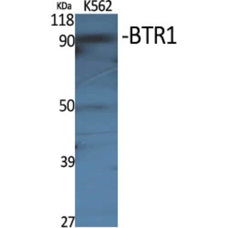 Western Blot - Anti-SLC4A11 Antibody (C18807) - Antibodies.com